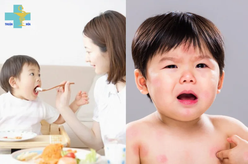chăm sóc bé bị rối loạn tiêu hóa